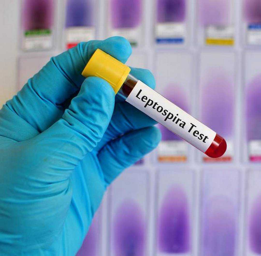 leptospirosis-lets-diskuss